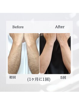 ティグレ 岡山店(TIGRE)/メンズ全身(顔VIO込)