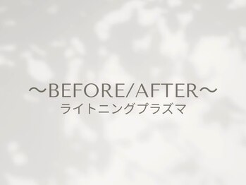 ビー(Be.)/プラズマbefore/after
