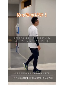 ウェルサス(WELLSUS)/１、インソール効果【反り腰】