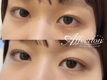 アフェクション アイビューティー(Affection eye beauty)/まつげパーマ