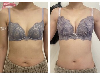 美人バスト 柏店/【バストアップ・育乳】症例