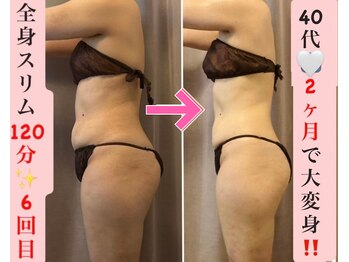 マール(Mar)/ビフォーアフター/痩身/全身痩せ