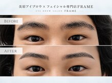 フレーム(FRAME)