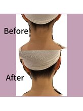 ミレア(Milea)/ビフォーアフター