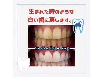 ホワイトニングショップ 倉敷店/