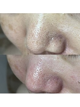 シャイニー(SHINY)/50代女性