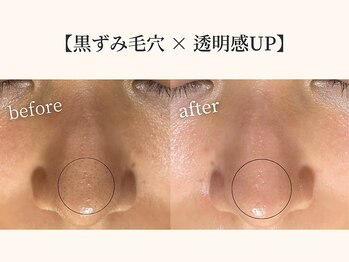 ドリームスパ 町田店(DREAM SPA)/before→after