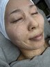 新メニュー！【ゾンビマスク】シワ、むくみ、毛穴改善