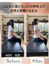 ウェルビーイング整体院 水戸赤塚店(wellbeing整体院)/Before After