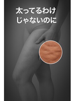 レチカ(Rechica)/理想ボディへ導く痩身ケア