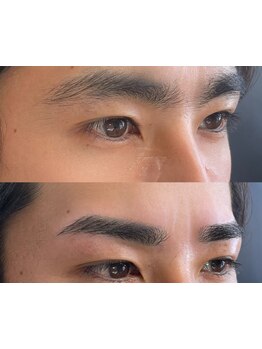 ムダ毛ケアをしたい