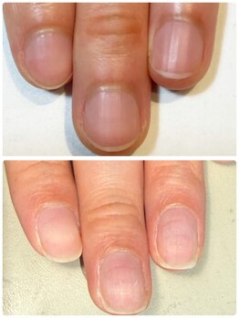ミリアネイル 成城(Miliea nail)/