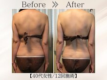 ソル(SOL.)の雰囲気（よもぎ蒸し×RF×強圧痩身リンパで、老廃物と脂肪をガッツリ流す）