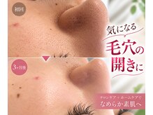 プレジール(Plaisir)