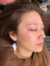 キュア アンド ケア ラボ タカハシ(TAKAHASHI )/どの角度でも、美しいフォルムに