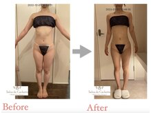 サロン ド カシェット 銀座/お客様のビフォーアフター例