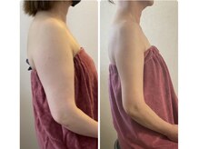 ブリランテ(Brillante)