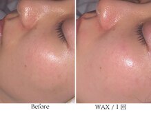 ビボーラ(BEBEAURA)/肌育WAX