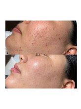 トータルビューティーサロンリア(Li'a)/ビフォーアフター