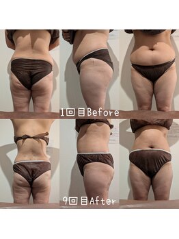 サロン ド モミカル(salon de momikaru)/