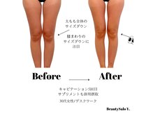 ワイドット(Y.)の雰囲気（内側＆外側からのアプローチで－10ｋｇ/二人三脚で全力サポート）