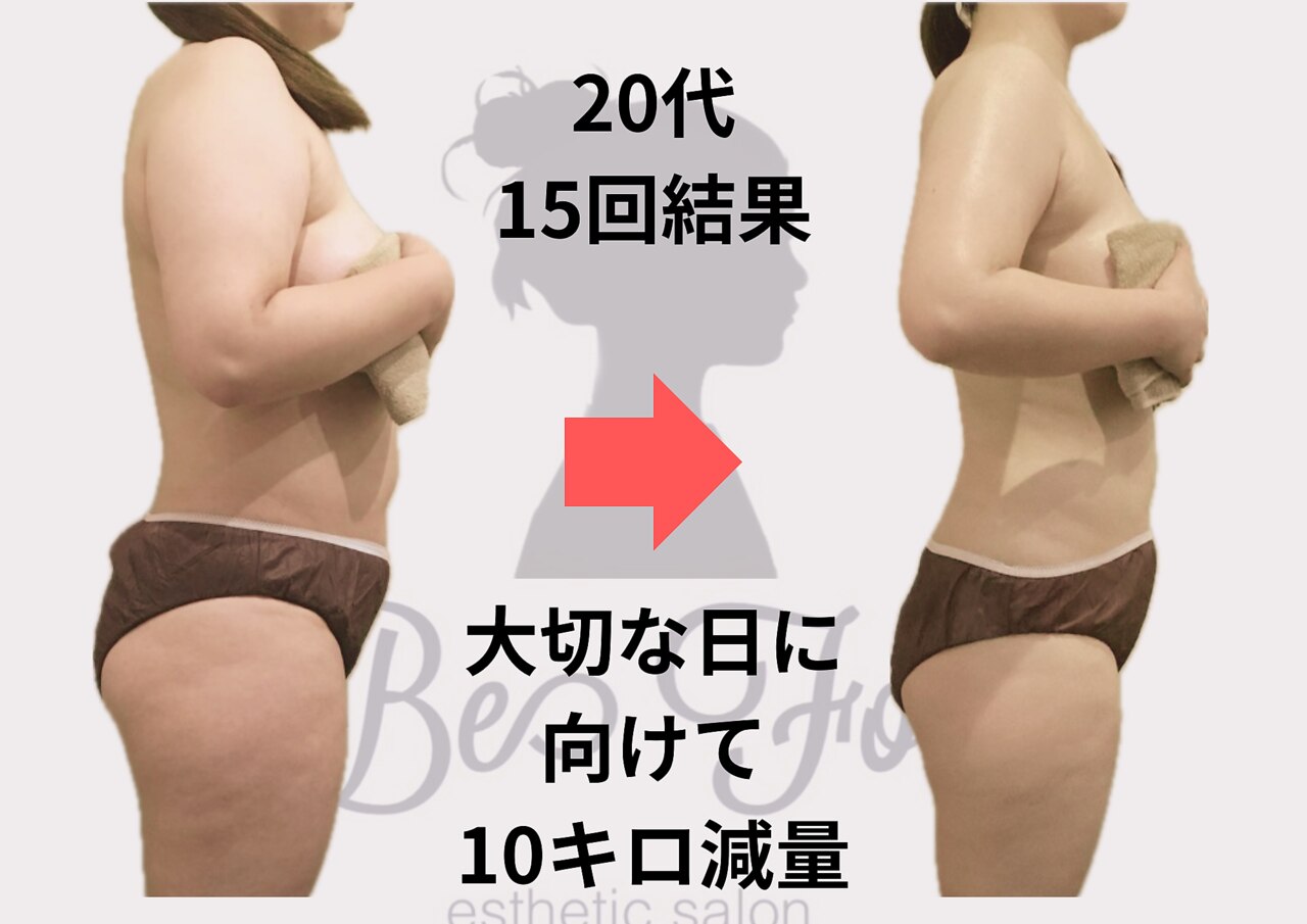 ビーフォー(be for)｜ホットペッパービューティー