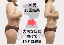 ビーフォー(be for)