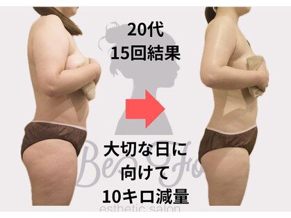 ビーフォー(be for)の写真