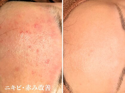 アクール(Accueil)の写真