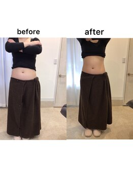 ジョワイユ(Joyeux)/腸の位置でお腹は変わる