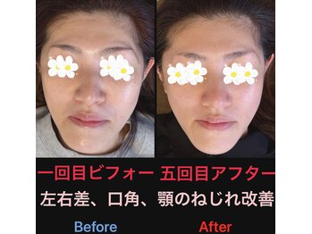 美容矯正サロン レレポノ(LELEPONO)/