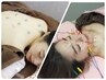【美容鍼80本以上で◎】全身美容鍼灸&頭皮電流(パック付)90分16800円