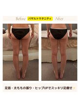 アイシー(I Sea)/バザルトマタニティ