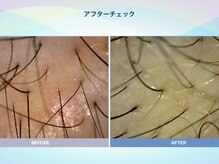 アンス(anth:)/お客様の仕上がり