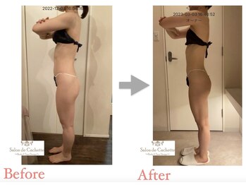 サロン ド カシェット 銀座/お客様のビフォーアフター例