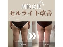 ペルフェクト(PERFECTO)の雰囲気（【即日実感】痩せやすく太りにくい体を作り上げる！食事指導も◎）