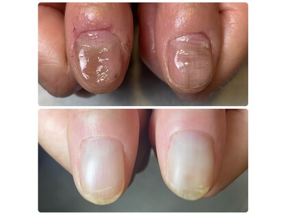 コルザ(COLZA)の写真