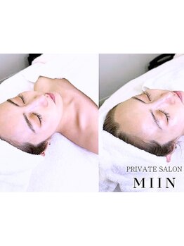 美白ケアをしたい