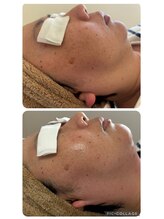 トータルビューティーアンドリラクゼーション K(Total Beauty ＆ Relaxation K)/フェイシャル　ラジオ派