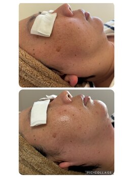 トータルビューティーアンドリラクゼーション K(Total Beauty & Relaxation K)/フェイシャル ラジオ派