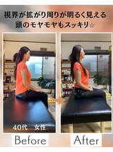 ウェルビーイング整体院 水戸赤塚店(wellbeing整体院)/Before After