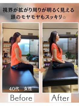ウェルビーイング整体院 水戸赤塚店(wellbeing整体院)/Before After