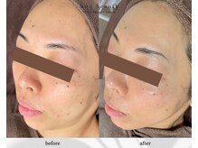 アン ビューティー(ann beauty)/月1回 定期的に通われてるお客様