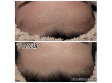 ウィズユー(with U)の雰囲気(フェイスWAX直後に毛穴黒ずみ解消/毛穴レス肌へ)