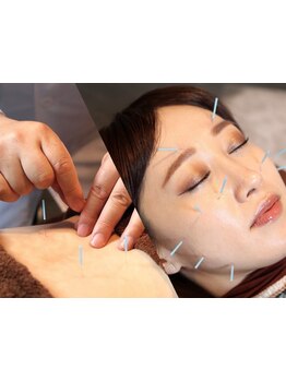 首・肩のつらさを改善したい