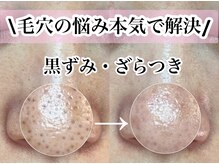 エミュ(emu)