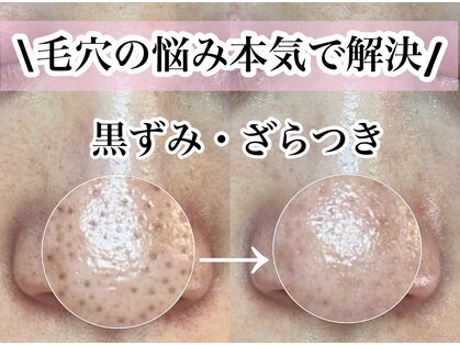 エミュ(emu)の写真