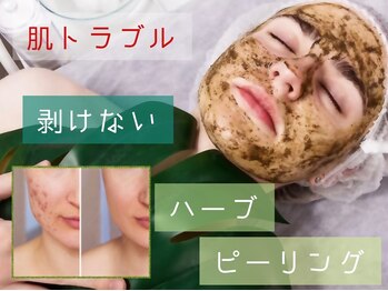 コネクトの写真/お顔/背中/デリケートゾーンのハーブピーリングが人気★IPLフェイシャル/インディバでダウンタイムケアも◎