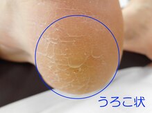 フットケアサロン ラビフット(Rabbi foot)/サンダルの準備、是非専門店で！