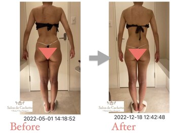 サロン ド カシェット 銀座/お客様のビフォーアフター例